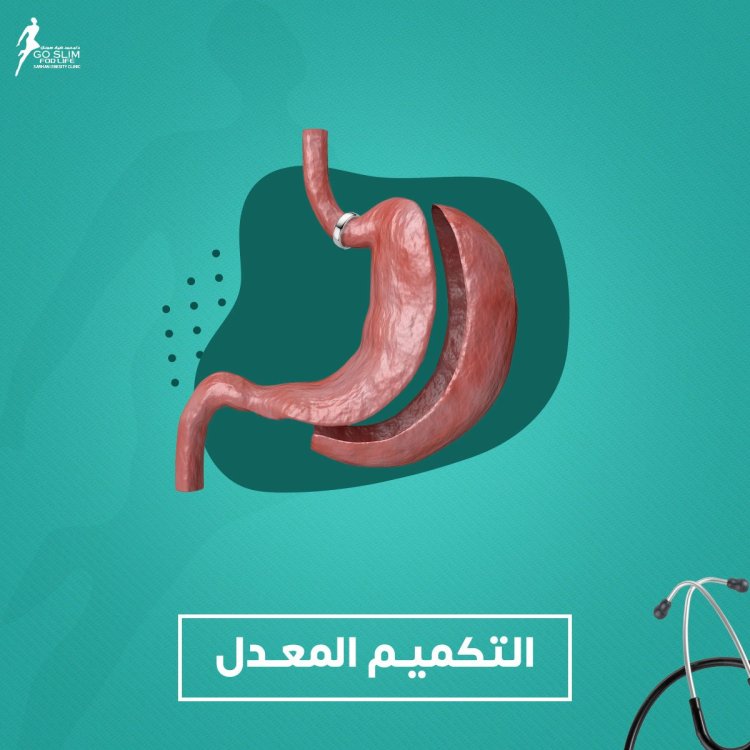 أفضل جراح سمنة في مصر